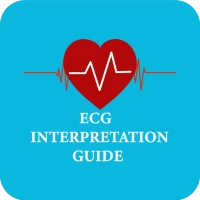 ECG Interpretation guide 2023